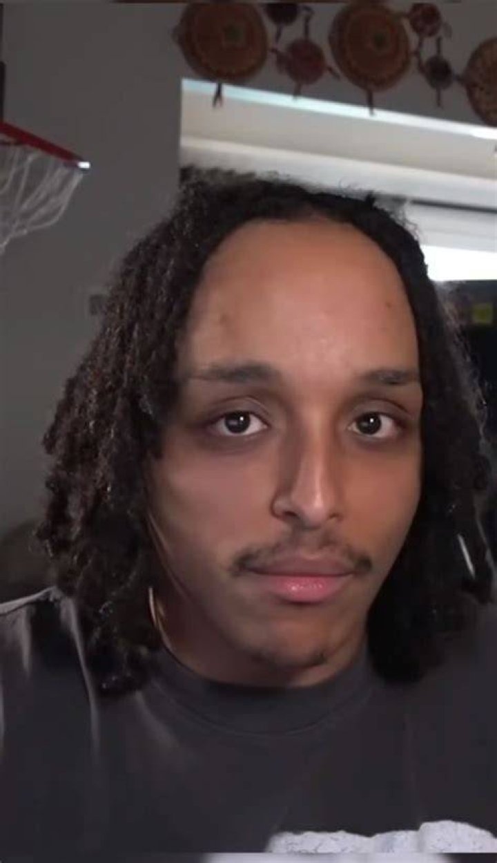 Agent 00 Forehead
