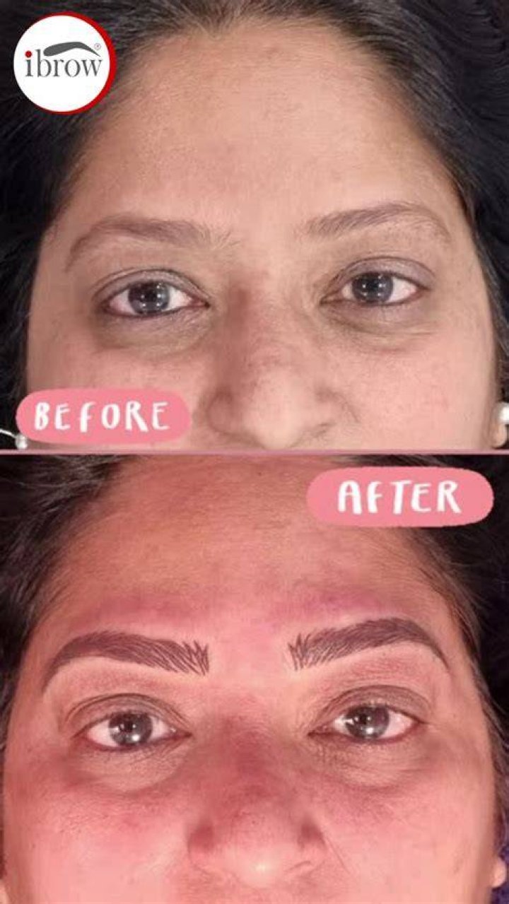 Before-after results Before-after results