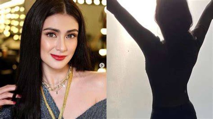 Carla Abellana