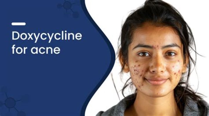 Doxycycline for acne: dosage, duration and side effects