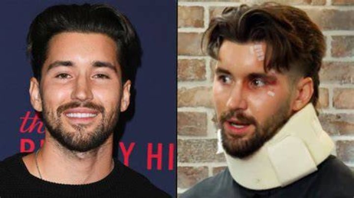 Jeff Wittek after his accident caused by David Dobrik