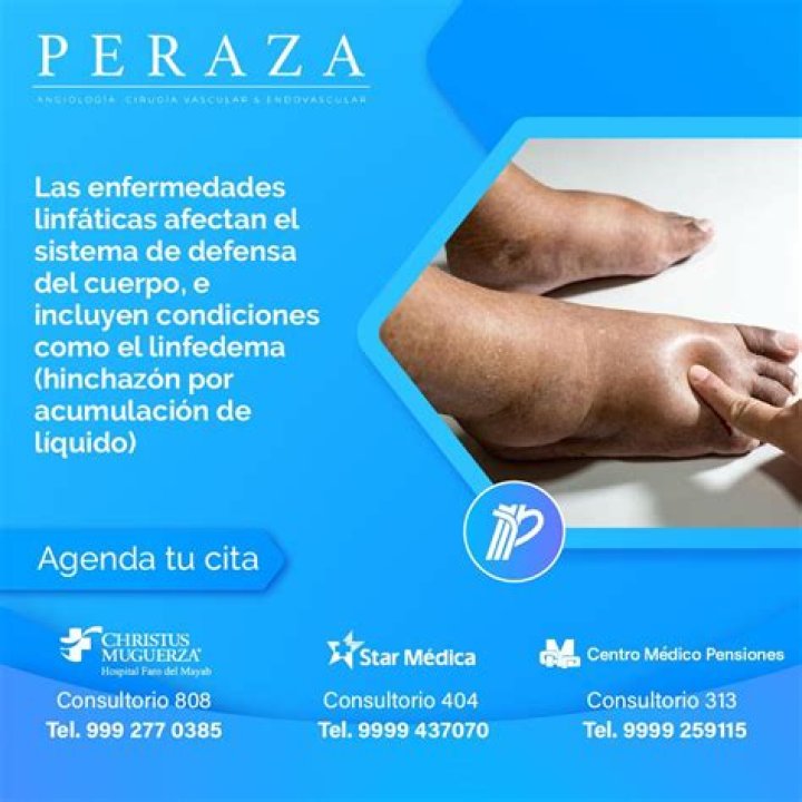 Jos&eacute; Peraza