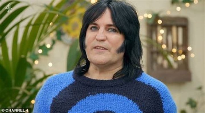 Noel Fielding health update
