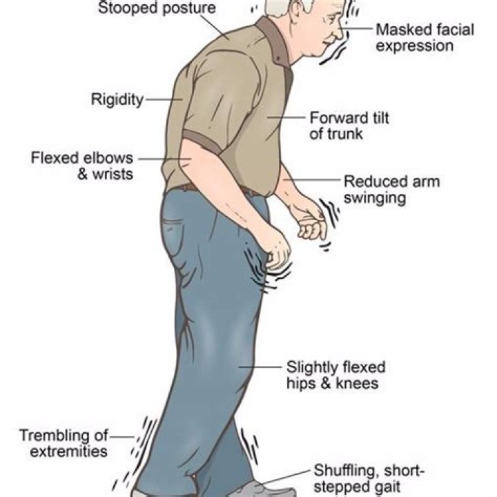 Parkinson's Disease