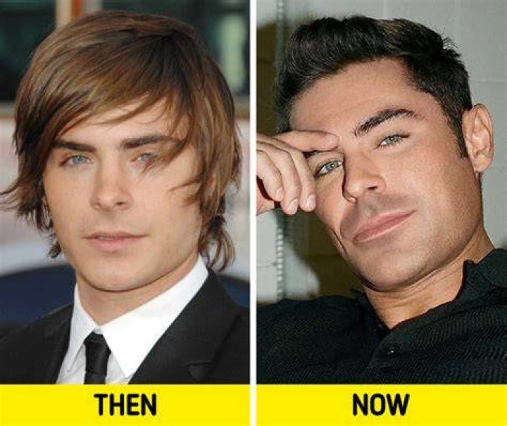 Plastic Surgery Rumors Surround His Cameo