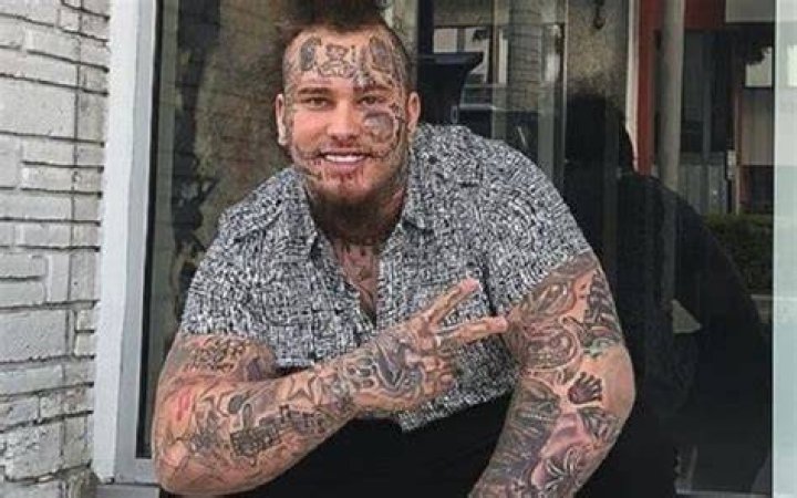 Rapper Stitches Rapper Stitches