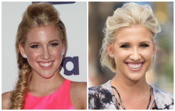 What Is Wrong With Savannah Chrisley Teeth? Used Braces Or Teeth Whitening Savannah Chrisley Teeth